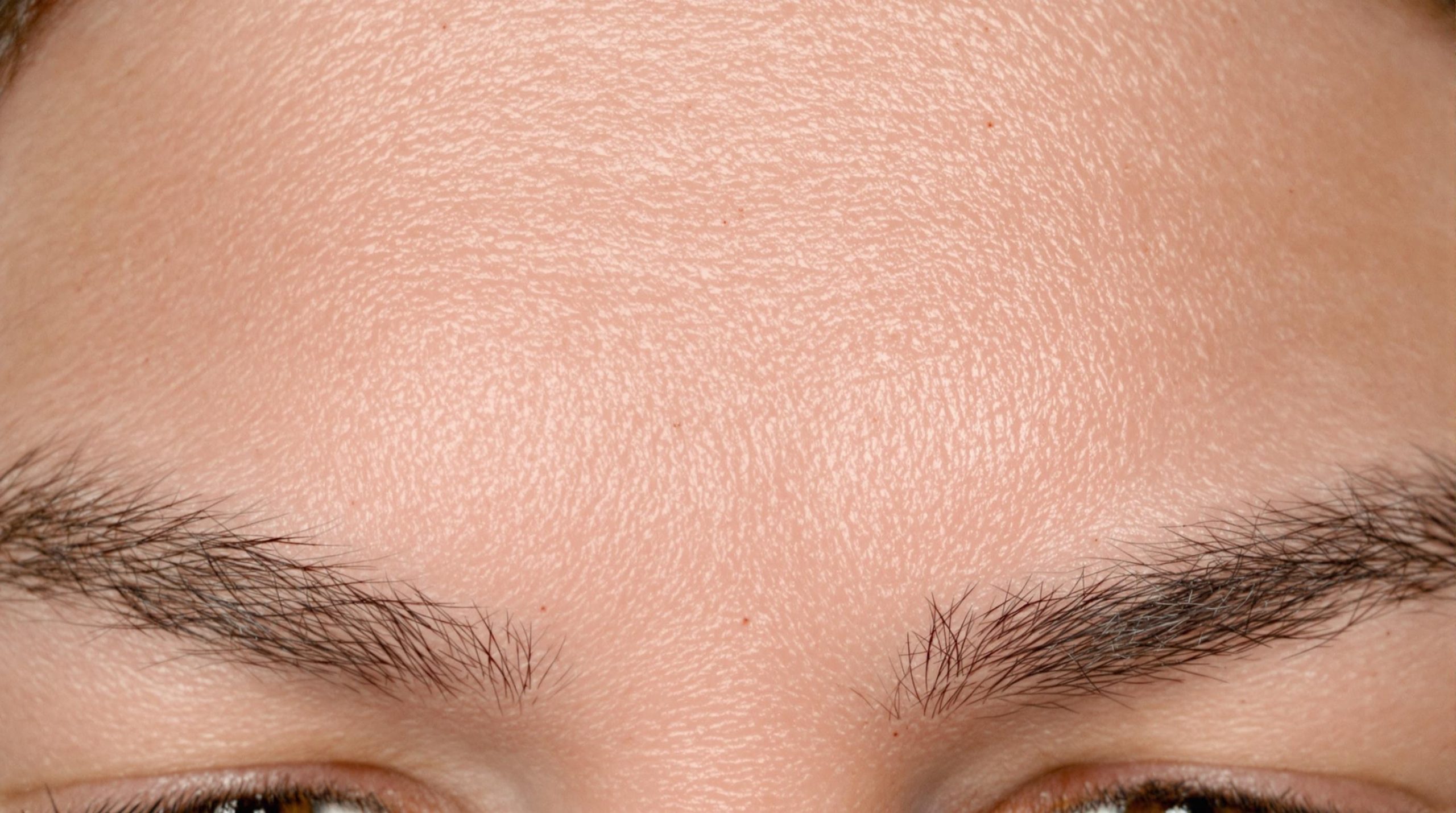 Comprendre et traiter la peau granuleuse sur le front